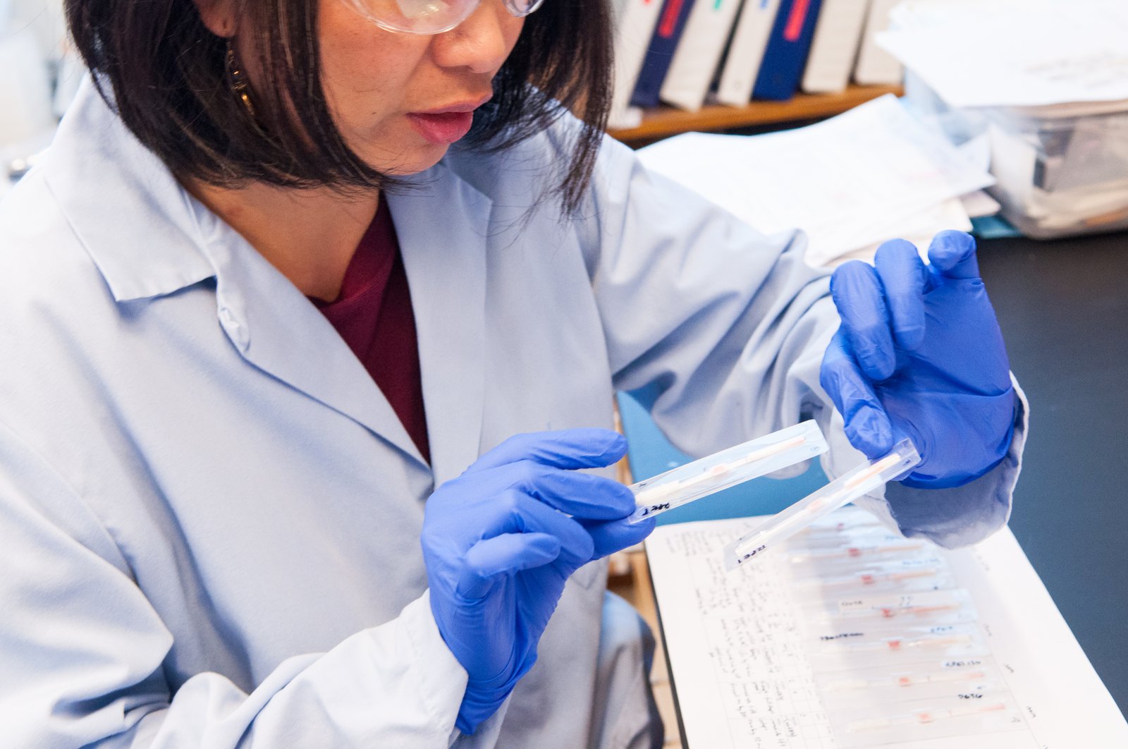 Tala de los Santos looks at onchocerciasis (river blindness) diagnostic tests.