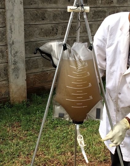 The bag-mediated filtration system (BMFS) created by PATH and the University of Washington.