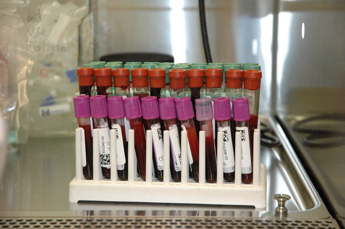 Samples waiting to be cataloged in the biorepository.