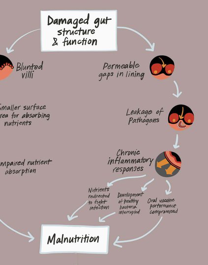 Good gut health is key to optimal growth and development. Without it, children can develop environmental enteric dysfunction, which can result in chronic malnutrition and stunting. Image: PATH.